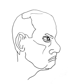 baldolineres.png
