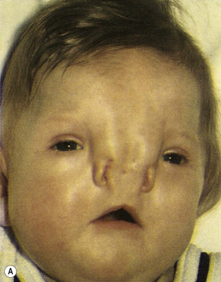 nose abnormality.jpg