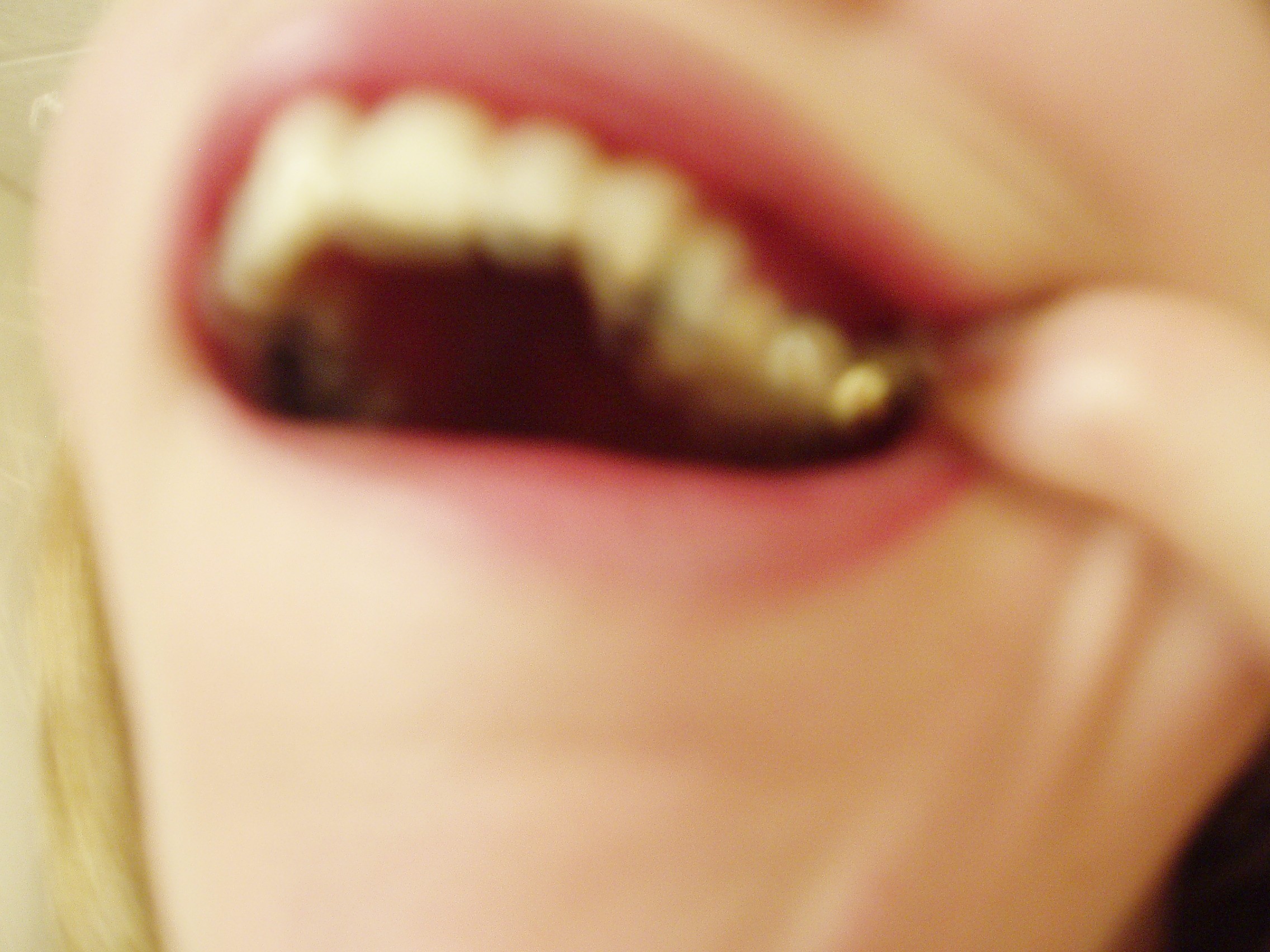 It's A Miracle!!!! I Got A Gold Tooth!!! Christian Forums