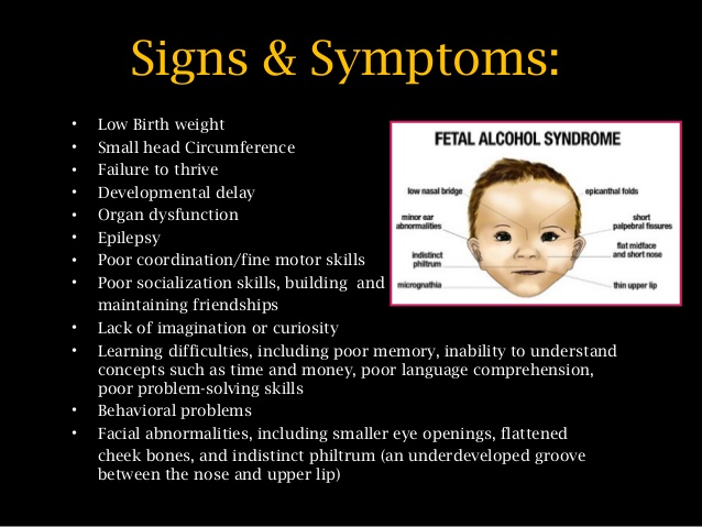 fetal-alcohol-syndrome-5-638.jpg