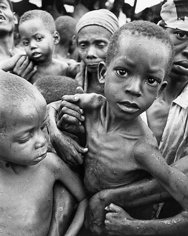 African-Children-Starving.jpg