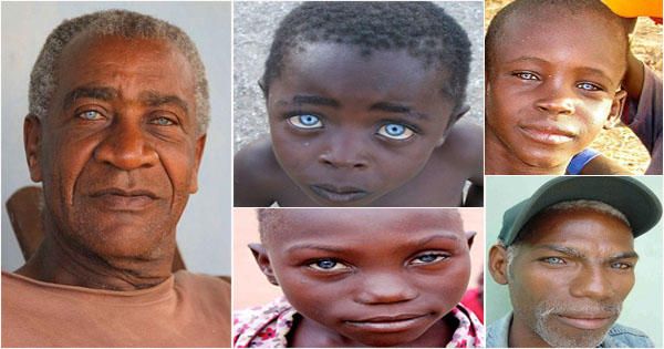 noir-yeux-bleus-black-people-blue-eyes.jpg