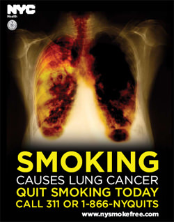 anti-smoking-poster-lungs.jpg