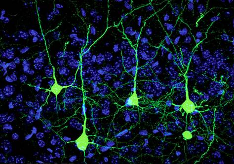 051212_neurons_hmed_1p.grid-6x2.jpg