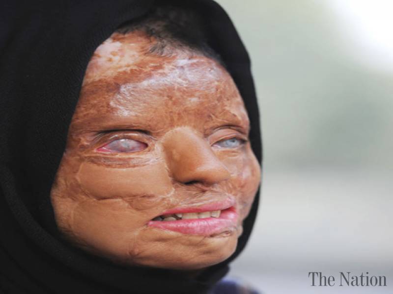 acid-attack-victim-who-became-a-tv-millionaire-1356285700-9509.jpg