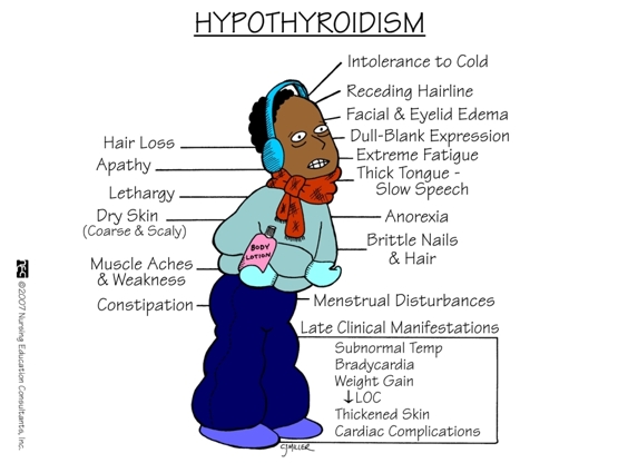 hypothyroidism-revolution.jpg