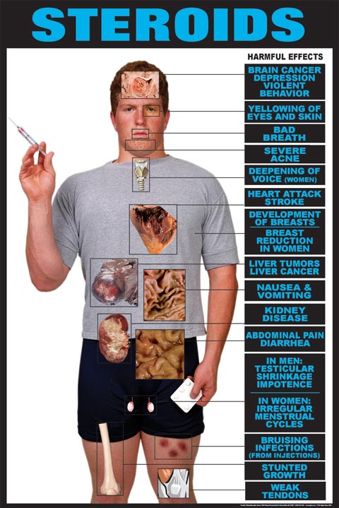 steroids-poster.jpg