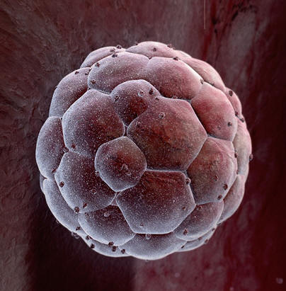 blastocyst.jpg