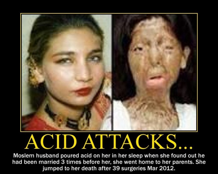 acid-attack-victim-before-after-e1359759915416.jpg