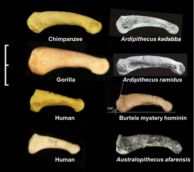 fourth-proximal-pedal-phalanges.png