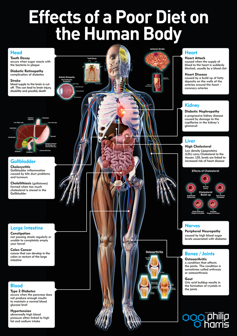 effects-of-a-poor-diet.png