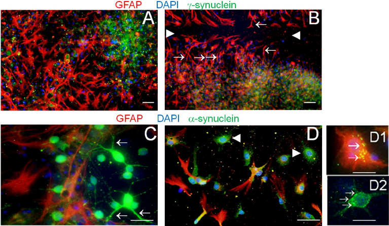 Fig-1-IF-staining-of-primary-cell-culture-from-mouse-brain-in-control-samples-A-C.png